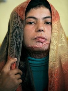 Women, such as this woman, are abused in countries such as Afghanistan.   Afghanistan is an example of a society that treats women like second-hand citizens and thus have disenfranchised them of their reproductive rights.